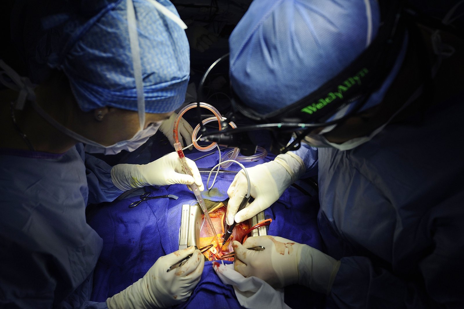 Heart surgery